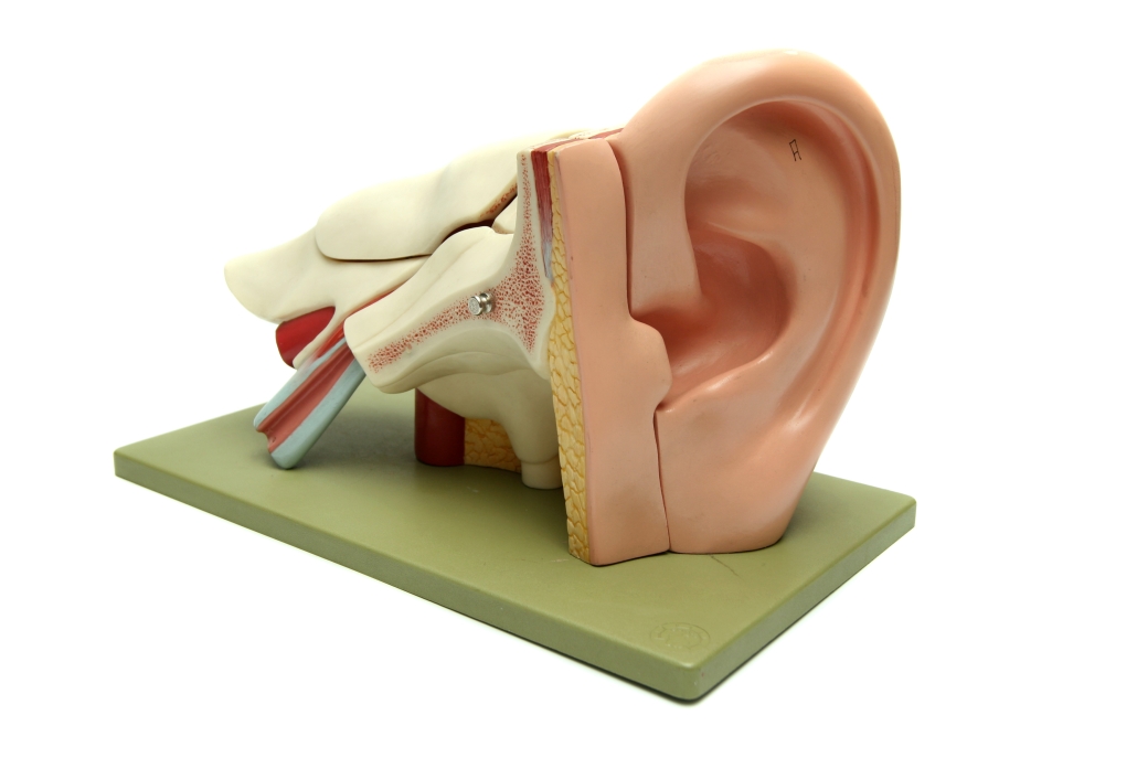 Idiopathic Sudden Sensorineural Hearing Loss (SSHL) Idiopathic Sudden Sensorineural Hearing Loss (SSHL)